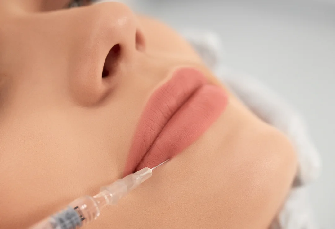 Dermal Fillers